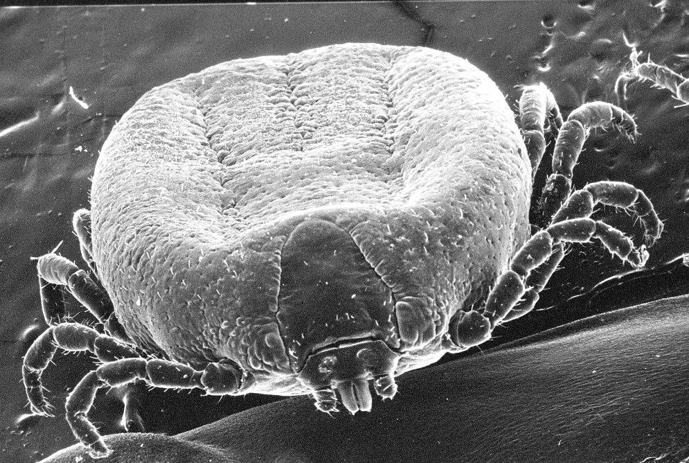 Electron micrograph of a partially engorged female hard tick
